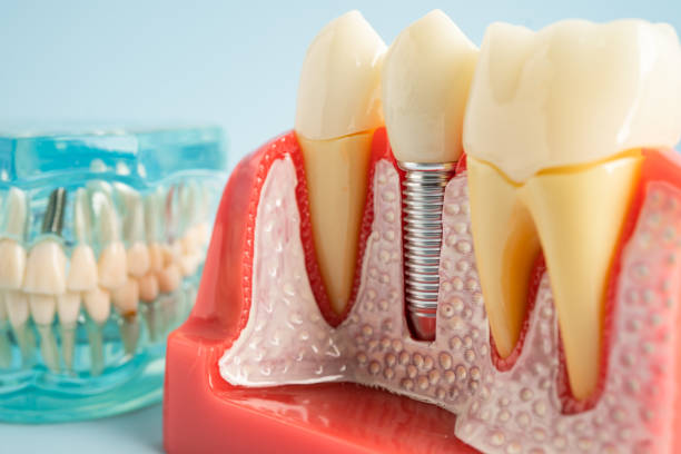 Best Root Canal Treatment  in Harsville, RI